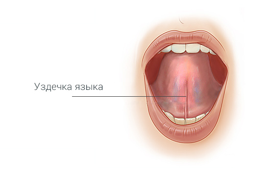 Пластика уздечки.jpg