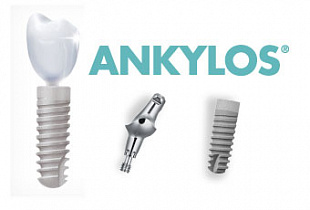 Импланты Ankylos